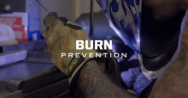 Preventing Burns in High-Heat Work Environments